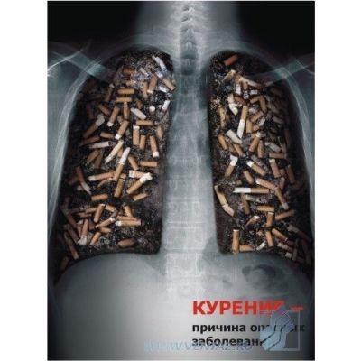 Комплект социальных плакатов (против курения, наркомании, алкоголизма), 3л., А3
